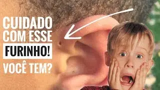 Você tem ou conhece alguém que tenha esses Furinhos?