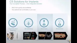 Carestream Dental SMOP Digital Dental Implant Guided Surgery