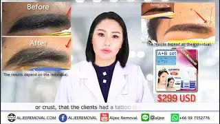 Eyebrows Tattoo Removal non-Laser : How to use the product.