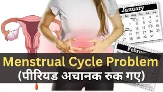 Menstrual cycle problem|| Suddenly period stop || Treatment of stop period