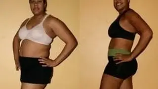 WLS:Black women find it harder to lose weight than white women