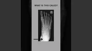 What is this called?#medical #anatomy #physiology #radiology #xray