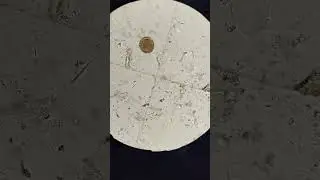 Ascaris Lumbricoides eggs under microscope
