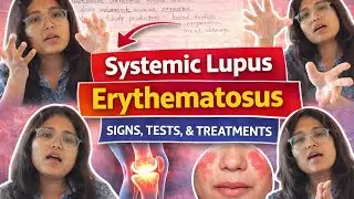 SLE = Systemic lupus erythromatous disease Part-1 #SCT HMC #HOMEOPATHY #Medicine #medicalstudent