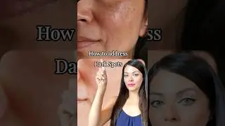 How to address dark spots? #skincare #makeup #makeuproutine #colorcorrector #coverage