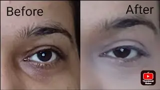 How to cover dark circle under eyes|anushree roy