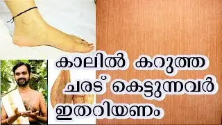 കാലിൽ കറുത്ത ചരട് കെട്ടുന്നത് ദോഷമോ ? WEARING BLACK THREAD  IN YOUR LEG  IS  WRONG ?