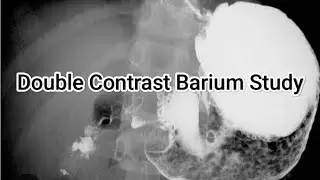 Double Contrast Barium Study | Notes | Prep&bull; Technique&bull; Adv and Disadv | #radiology #medicalstudent