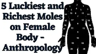 5 types of moles that is luckiest and richest moles