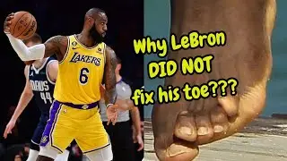 WHY LEBRON JAMES DID NOT FIX HIS MISALIGNED FOOT