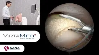 VirtaMed ArthroS&trade; Shoulder &ndash; Rotator Cuff Repair