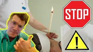 Безопасно ли использовать ушные свечи для удаления ушной серы? Врач объясняет... #шорты