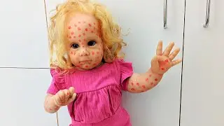 Reborn Girl Has Chicken Pox And Freaks Out