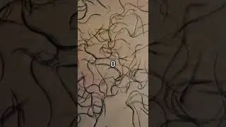 Bleach vs. parasites under the microscope!🦠💥 See the action! #Microscope #Science #Parasites #Bleach