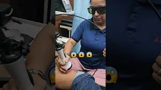 🤯😱 Most Advanced Class IV Laser Therapy #physiotherapy #aprc #chiropractor