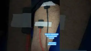 Muscle stimulation for quadriceps muscle #shortsyoutube #jaipur #recover #drrahulkumar #shorts