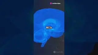 Can brain implants give us superintelligence?#BrainImplants #Neuroenhancement #FutureOfIntelligence