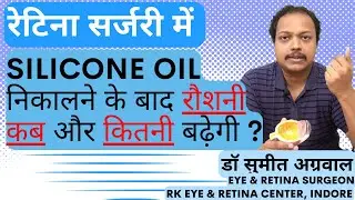 Silicone oil हटाने के बाद रौशनी कब और कितनी बढ़ेगी ? Vision recovery after Silicone oil removal.