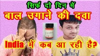 यह दवा आपको कभी गंजा नहीं होने देगी | Way 316606 | Full details