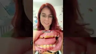 Dinții copilului tău sunt galbeni indiferent de ce ai face?🦷