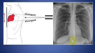 Back To The Basics - Chest X ray Interpretation Part 1