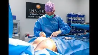 Breast Augmentation with silicone implants by Dr Jack