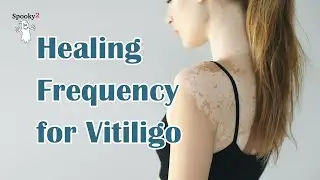 The Natural Solution for Vitiligo with Rife Frequencies | Heal Your Skin |Spooky2 Frequency Healing