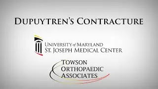 Dupuytren's Contracture - Michael Marion, MD - Orthopedic Surgeon