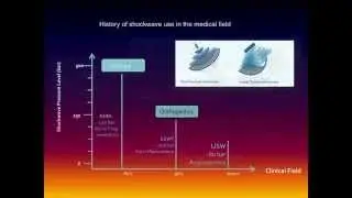 LSTC-ED Erectile Dysfunction treatment with Linear Shockwave | Presentation by MD Igor Motil