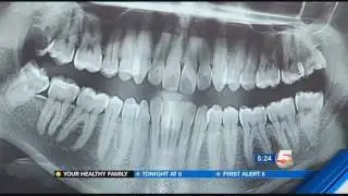 Your Healthy Family Cosmetic Orthodontics   KOAA com  Continuous News  Colorado Springs and Pueblo