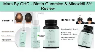 Mars By GHC - Biotin Gummies and Minoxidil 5% Review | Unboxing