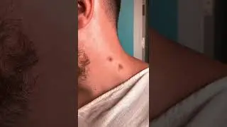 My thoughts when 2 mosquitoes bit in the neck. 🦟 #vampire #vampires #vines