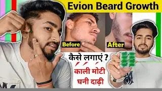 Evion 400 For Beard Growth How to Use | Evion Beard Growth