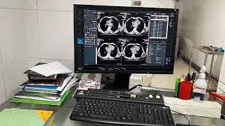 CT. Urogram / CTU Discussion