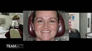 Clinical Demonstration of How to Obtain Extra-Oral Dental Photos TEAM ACT