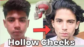 How to Get Hollow Cheeks As a Indian || In Hindi