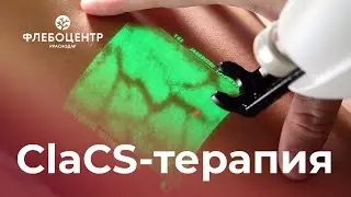 📌  ClaCS-терапия