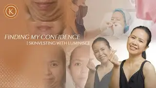 Finding my confidence | SkinVesting with Luminisce