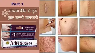Mederma Cream | How to Remove Cut Marks In Hindi | मेडरमा क्रीम कब तक लगाएं और ठीक कब होगा