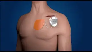 TYRX Envelope Overview Animation