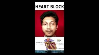 what is heart block# হার্ট ব্লক #shortsyoutube #shortvideos #pacemaker/ #SAnode