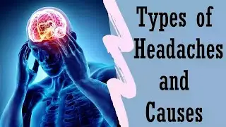 Types of Headaches and Causes | Dr. P Uday Kiran | Tirupati