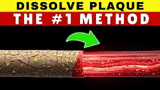 The #1 Way to Lower LDL Cholesterol Without Meds