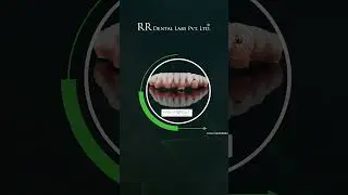 Fire & Forget: Instant Implant Prosthesis by RR Dental Labs