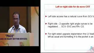 LV lead implantation &ndash; Dr Soumen Devidutta