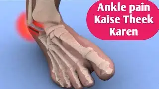 Ankle Sprain Treatment: Home remedy | Hindi | RICE protocol | Ankle sprain treatment