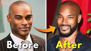 Grow your Beard Faster as a Black Men
