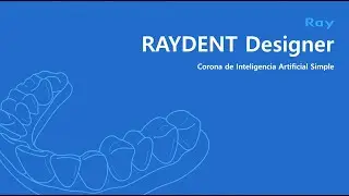 RAYDENT Designer: Corona de Inteligencia Artificial Simple