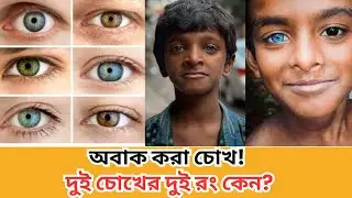 হেটারোক্রোমিয়া: কেন দুই চোখের রং ভিন্ন? Heterochromia: Why Two Different Eye Colors? Net Duniya