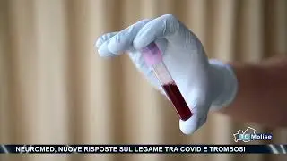 Neuromed, nuove risposte sul legame tra covid e trombosi
